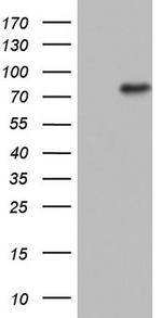 N4BP2L2 Antibody in Western Blot (WB)
