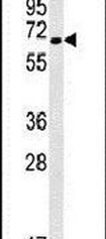 N4BP3 Antibody in Western Blot (WB)