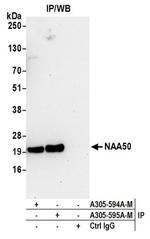NAA50 Polyclonal Antibody