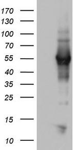NAB1 Antibody in Western Blot (WB)