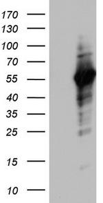 NAB1 Antibody in Western Blot (WB)