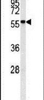 NAB2 Antibody in Western Blot (WB)