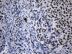 NABP1 Antibody in Immunohistochemistry (Paraffin) (IHC (P))