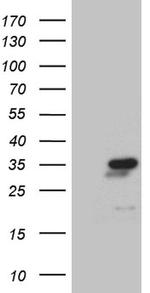 NABP1 Antibody in Western Blot (WB)
