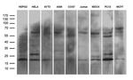 NABP1 Antibody in Western Blot (WB)