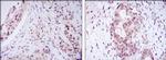 NAC1 Antibody in Immunohistochemistry (Paraffin) (IHC (P))
