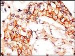 NAE1 Antibody in Immunohistochemistry (IHC)