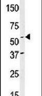 NAE1 Antibody in Western Blot (WB)