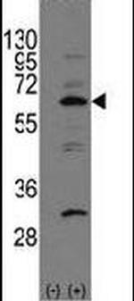 NAE1 Antibody in Western Blot (WB)