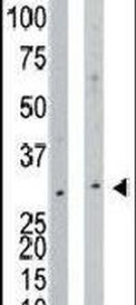 NAGK Antibody in Western Blot (WB)