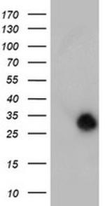 NANP Antibody in Western Blot (WB)