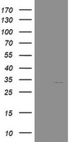 NANP Antibody in Western Blot (WB)