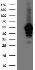 NAPEPLD Antibody in Western Blot (WB)