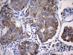 NAPSA Antibody in Immunohistochemistry (Paraffin) (IHC (P))