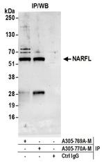 NARFL Antibody in Immunoprecipitation (IP)