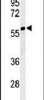 NARFL Antibody in Western Blot (WB)