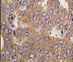 NARS2 Antibody in Immunohistochemistry (IHC)
