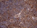 NARS2 Antibody in Immunohistochemistry (Paraffin) (IHC (P))