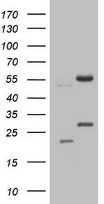 NARS2 Antibody in Western Blot (WB)