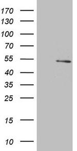 NARS2 Antibody in Western Blot (WB)