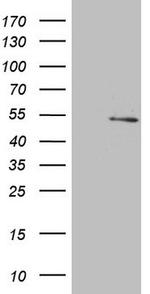NARS2 Antibody in Western Blot (WB)