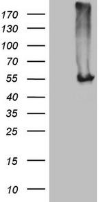 NARS2 Antibody in Western Blot (WB)