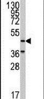 NARS2 Antibody in Western Blot (WB)