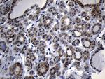 NAT1 Antibody in Immunohistochemistry (Paraffin) (IHC (P))