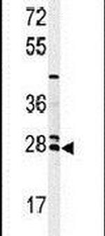 NAT8 Antibody in Western Blot (WB)