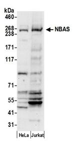 NBAS Polyclonal Antibody