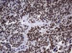NBN Antibody in Immunohistochemistry (Paraffin) (IHC (P))