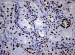 NBN Antibody in Immunohistochemistry (Paraffin) (IHC (P))