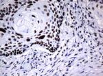 NBN Antibody in Immunohistochemistry (Paraffin) (IHC (P))
