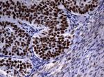 NBN Antibody in Immunohistochemistry (Paraffin) (IHC (P))