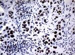 NBN Antibody in Immunohistochemistry (Paraffin) (IHC (P))