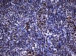 NBN Antibody in Immunohistochemistry (Paraffin) (IHC (P))