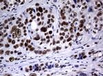 NBN Antibody in Immunohistochemistry (Paraffin) (IHC (P))