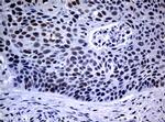 NBN Antibody in Immunohistochemistry (Paraffin) (IHC (P))