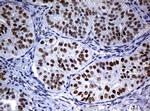 NBN Antibody in Immunohistochemistry (Paraffin) (IHC (P))
