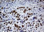 NBN Antibody in Immunohistochemistry (Paraffin) (IHC (P))