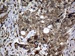 NBN Antibody in Immunohistochemistry (Paraffin) (IHC (P))