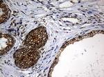 NBN Antibody in Immunohistochemistry (Paraffin) (IHC (P))