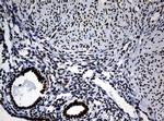 NBN Antibody in Immunohistochemistry (Paraffin) (IHC (P))