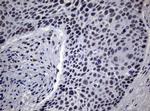 NBN Antibody in Immunohistochemistry (Paraffin) (IHC (P))