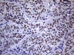 NBN Antibody in Immunohistochemistry (Paraffin) (IHC (P))
