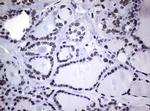 NBN Antibody in Immunohistochemistry (Paraffin) (IHC (P))