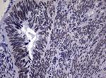 NBN Antibody in Immunohistochemistry (Paraffin) (IHC (P))