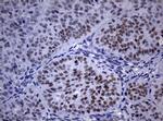 NBN Antibody in Immunohistochemistry (Paraffin) (IHC (P))