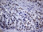 NBN Antibody in Immunohistochemistry (Paraffin) (IHC (P))