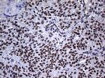 NBN Antibody in Immunohistochemistry (Paraffin) (IHC (P))